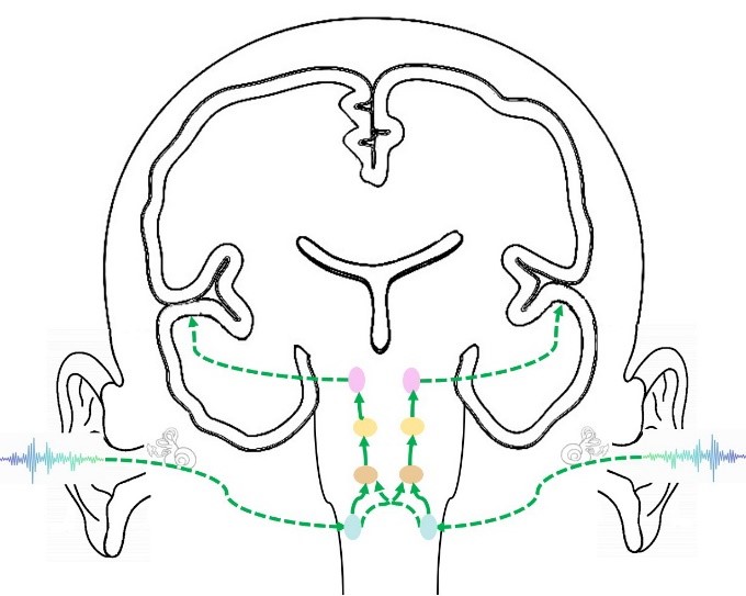 Image of auditory pathways