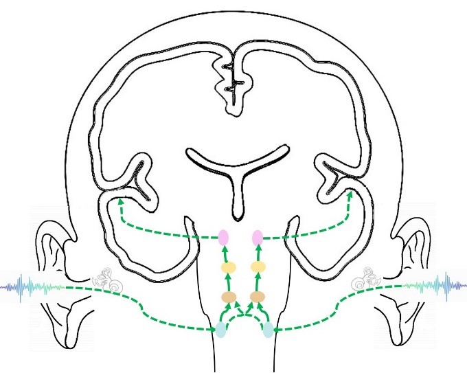 Central Auditory Processing Disorders (CAPD) Tools and Resources ...